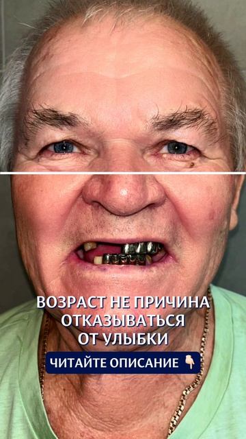 Кейс пациента