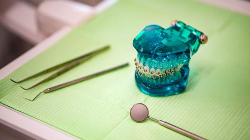 Стоматолог развеял миф о влиянии брекетов на осанку