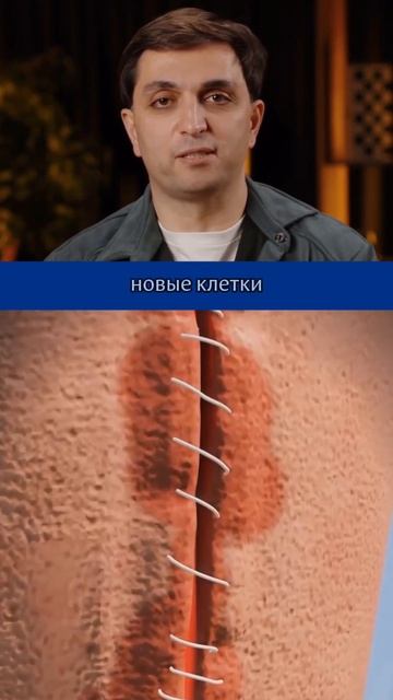 А вы знали, что делает врач при глубокой ране