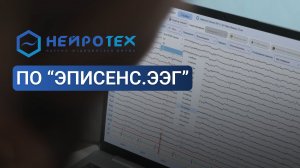 ПО «Эписенс.ЭЭГ»: обзор возможностей и интерфейса
