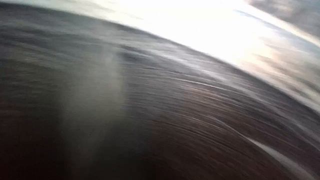 Эндоскопия 565