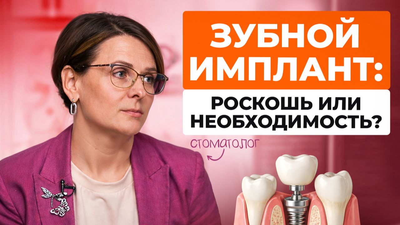 Зубной имплант – роскошь или необходимость? Какие плюсы и минусы имплантации зуба