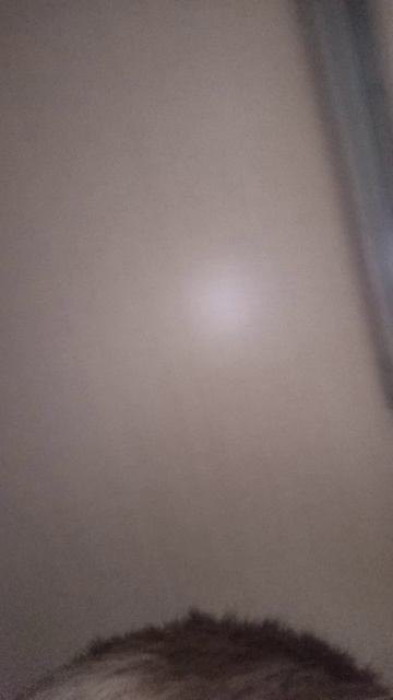 У меня большая родинка