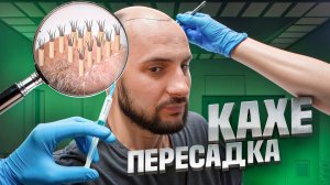 КАХА ПЕРЕСАЖИВАЕТ ВОЛОСЫ