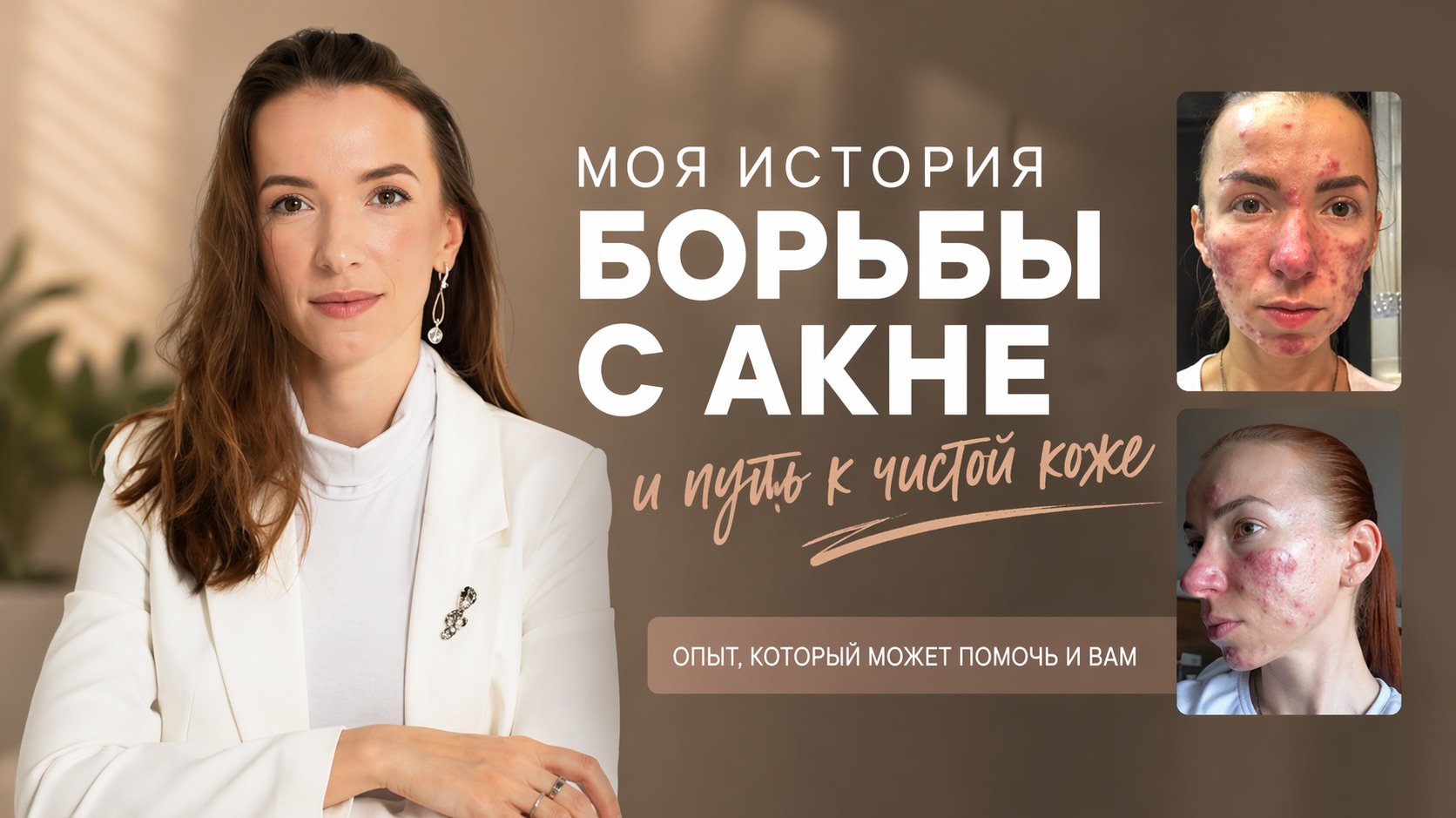 Как я восстановила проблемную кожу | история создания ухода