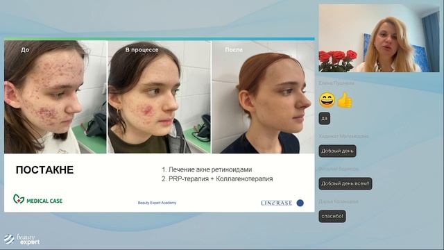 Клинический слуйчай Постакне