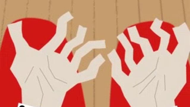 Arthritis-finger ппп