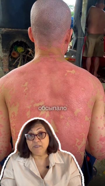 Игнорируешь псориаз? Сейчас бляшки  через 5 лет вот что Смотри лекцию в шапке профиля 