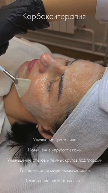 Карбокситерапия