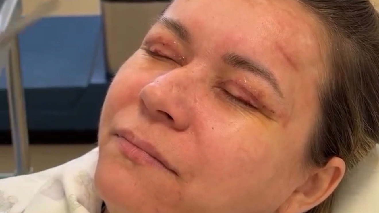 Иришка помолодела на 10 лет! Всем такого же доктора! Чики Пики