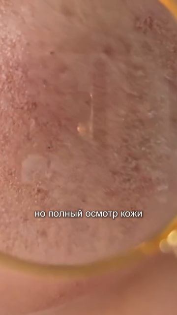 Очень часто опасные образования остаются незамеченными, потому что они не бросаются в глаза 👇