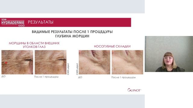 Реабилитация после пластических операций, аппаратных и инъекционных процедур с Hydradermie 1000