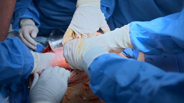 Больница Питт 2 сезон 15 серия «9:00 P.M.» (сериал, 2026)