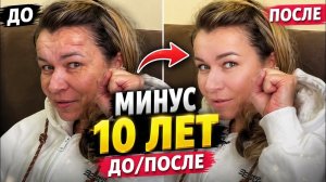 Иришку не узнать! Операция прошла успешно, теперь всё Чики Пики