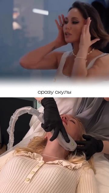 SMAS (contlex) — аппарат предназначен для нехирургической подтяжки кожи!💎