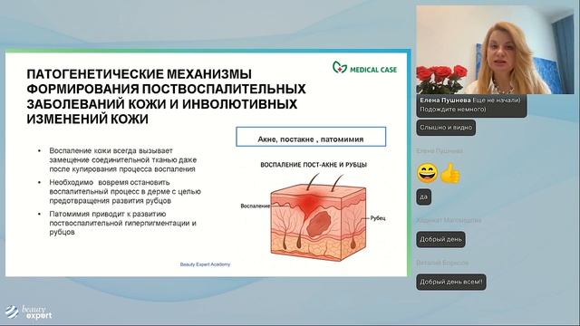 Патогенетические механизмы формирования поствоспалительных заболеваний кожи