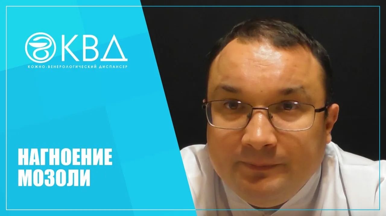 1263  Нагноение мозоли