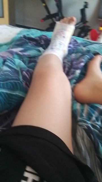 у меня перелом❤️🩹