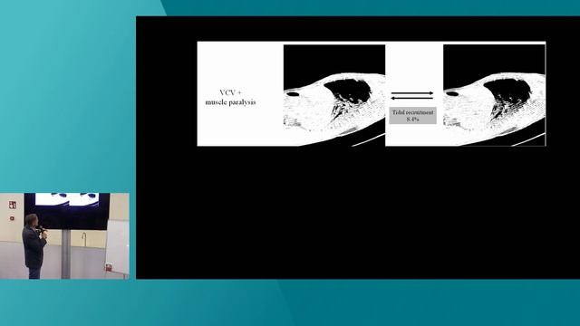 The Role Of Muscle Pressure In Lung Protective Ventilation Marcelo Amato ISICEM45