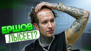 ЕРШОВ ЛЫСЕЕТ ПЕРЕСАДКА ВОЛОС МАМЕ