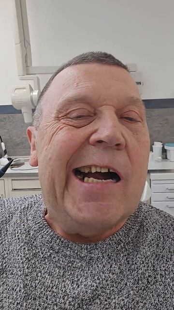 Что произойдет с зубами после длительных операций #стоматология #здоровье