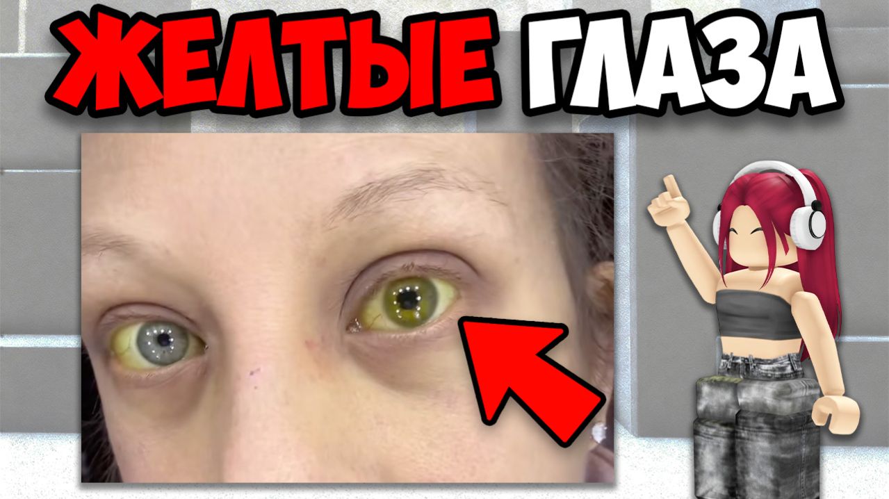 САМЫЕ СТРАШНЫЕ БОЛЕЗНИ В МИРЕ