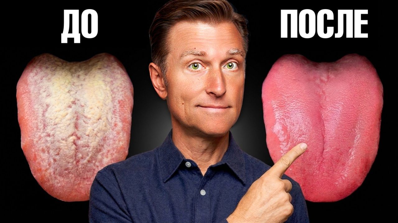 Как избавиться от кандиды за 24 часа?