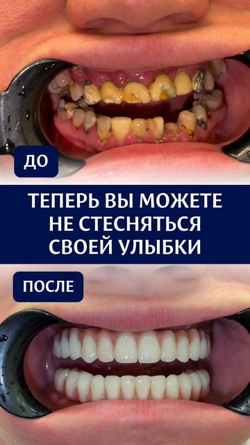 Кейс пациента