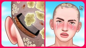 АСМР: ФУ, НУ И ГАДОСТЬ! 🤢УДАЛЕНИЕ ПЕРХОТИ И НАСЕКОМЫХ С ГОЛОВЫ СПОРТСМЕНА!!