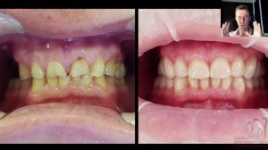 ПроПреп (чать 5)