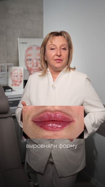 КОНТУРНАЯ ПЛАСТИКА ГУБ: как 1 мл возвращает лицу идеальный баланс