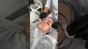 Максимальный Anti-Age эффект: V CARBON + Lift&Up