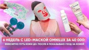 6 недель с LED‑маской Omnilux за 40 000 😳