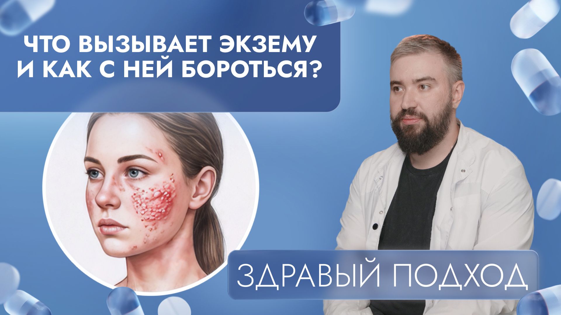 Что вызывает экзему и как с ней бороться? | Здравый подход (2026)