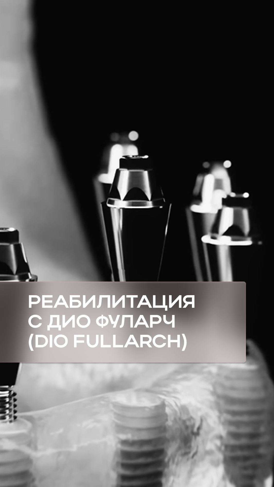 ДИО ФулАрч DIO FullArch  система для полной реабилитации беззубой челюсти с опорой на импланты 