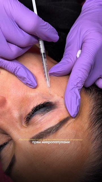 Как убрать морщины под глазами?