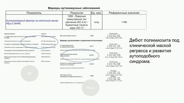 Аутизм. Эволюция медицинских подходов и определения прогноза восстановления ребенка с РАС