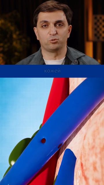 Как появляется синяк