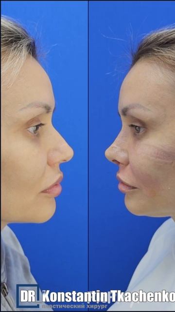 «ХОЧУ КУКОЛЬНЫЙ НОС❗️»