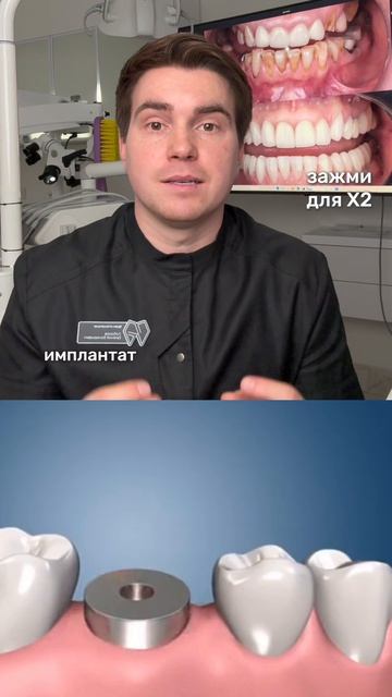 Премиум - это сохранение своего зуба или имплантация?