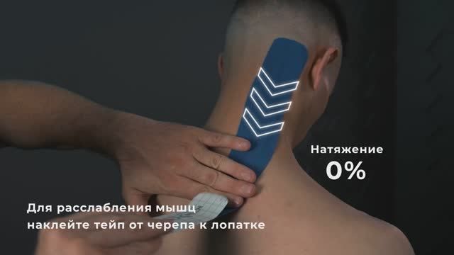 Тейпирование ременной мышцы головы с KineXib: Избавляемся от головных болей и «скованной» шеи