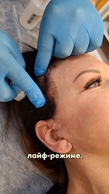 Комплексное омоложение - результат сразу после пластической операции!