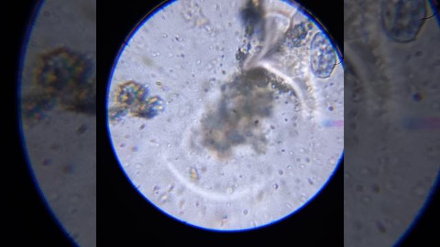 Инфузории на кормежке