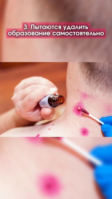 Как снизить риск рака кожи  👇