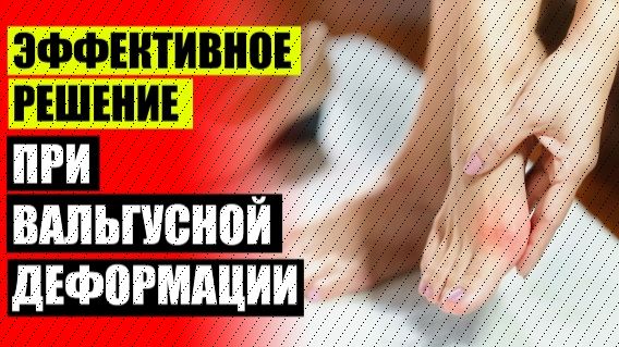 🤕 Valguloc отзывы ❕ Большие косточки на ногах 👍