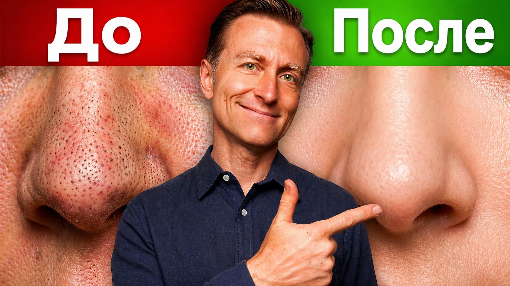 Лучшее средство от черных точек, которое действительно работает!📚😊✔