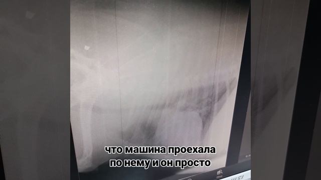 Слезы на глазах от такого. ДРУЖОЧЕК В БЕДЕ: и каждый день что-то новое. Отёк сходит, становится ясне