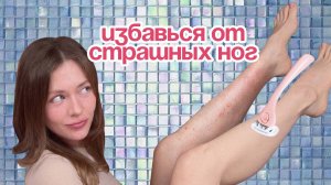 ГЛАДКИЕ НОГИ: избавляемся от КЕРАТОЗА, вросших волос, синевы