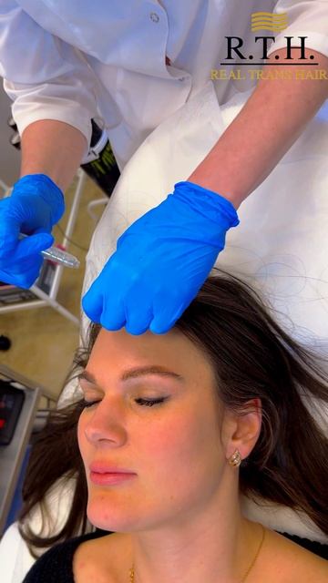 Газожидкостный пилинг при себорее!