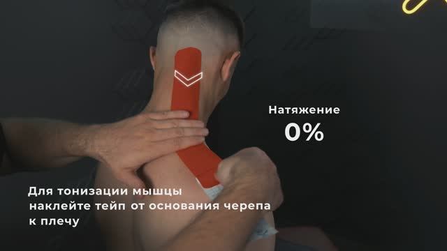 Тейпирование верхней трапециевидной мышцы с KineXib: Снимаем боль, напряжение и «каменные» плечи